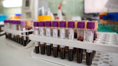 Ученые нашли связь группы крови с опасными болезнями