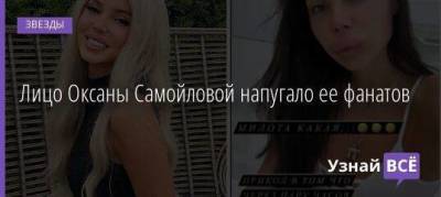 Лицо Оксаны Самойловой напугало ее фанатов