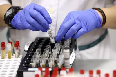 Более 150 новых случаев коронавируса выявлено в СКФО