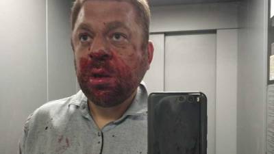 Сегодня утром в ХМАО избили депутата Антона Пантина