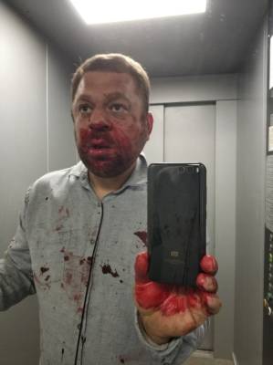 В ХМАО избили оппозиционного журналиста и общественного активиста