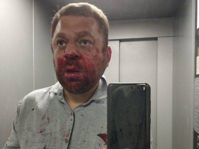 В ХМАО избит оппозиционный журналист
