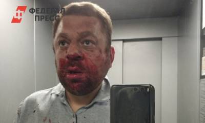 В Югорске оппозиционера Антона Пантина избил неизвестный в маске