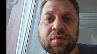 В Югорске неизвестный избил журналиста Антона Пантина
