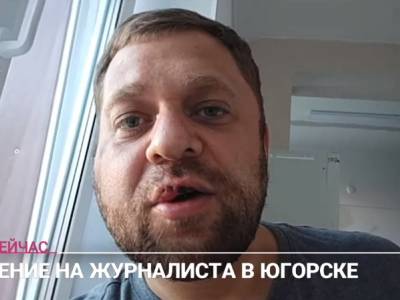 В ХМАО избили журналиста, критиковавшего местную власть