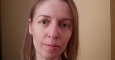 "Рак меня убивает": Юлия просит помочь ей пройти дорогостоящее лечение