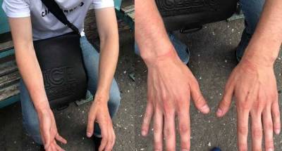 В Одессе полицейский ради "воспитания" заковал в наручники и избил 17-летнего парня