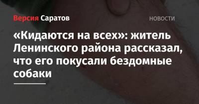«Кидаются на всех»: житель Ленинского района рассказал, что его покусали бездомные собаки