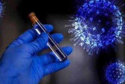 Еще 49 человек заболели коронавирусом в Чувашии, один умер