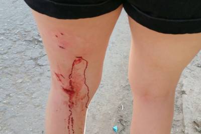 Рязанская прокуратура начала проверку после нападения бродячих собак на девочку