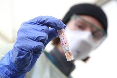 В Смоленске еще 30 человек заболели коронавирусом