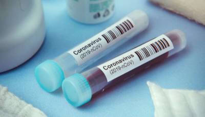 Украина фиксирует резкий скачок суточной смертности от коронавируса