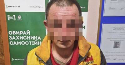Облил кислотой жену и детей: в Николаевской области суд вынес приговор семейной обидчику
