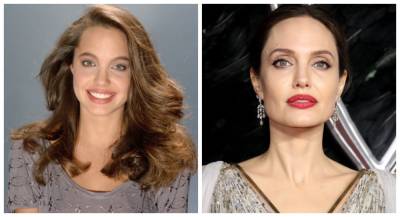 Делала ли пластику Анджелина Джоли: Комментарий эксперта