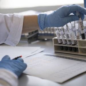 В Австралии разрабатывают лекарство от коронавируса, не дающее ему попадать в клетки