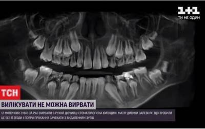 Под Киевом стоматолог удалил ребенку 12 зубов без согласия родителей - СМИ