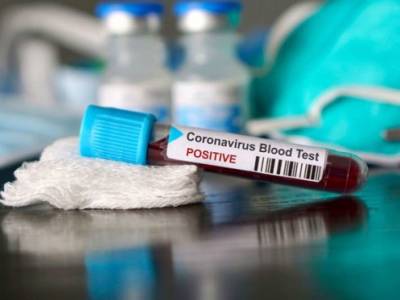 Количество инфицированных коронавирусом киевлян выросло почти в два раза