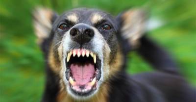 В Мурманске бродячие собаки едва не загрызли школьницу, оставив на теле свыше сотни укусов