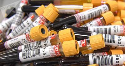 Ученые из Швейцарии разработали тест для определения антител к COVID по капле крови - ru.armeniasputnik.am - Швейцария