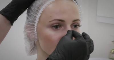 Хрящ, напечатанный на 3D-принтере, может восстановить нос после рака кожи (видео)