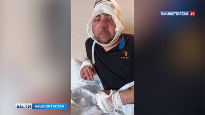 Жуткие травмы: житель Башкирии записал видео после нападения медведя