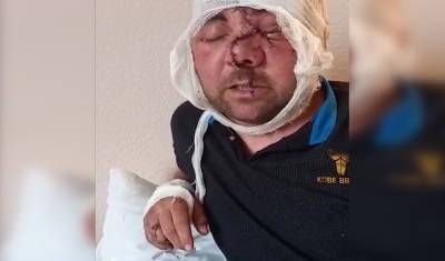 Мужчина показал на видео полученные травмы после нападения медведя в Башкирии