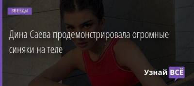 Дина Саева - Дина Саева продемонстрировала огромные синяки на теле - skuke.net - Россия