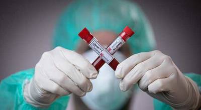 В Украине коронавирусом за сутки заболели почти 9 тысяч человек