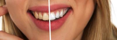 Стоматолог предупредил о неочевидной опасности отбеливания зубов