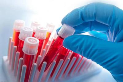 Группу крови, которая обеспечивает самый мощный иммунитет, назвали ученые - lenta.ua