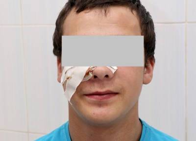 Иркутские врачи спасли подростка, у которого в лице застряла палка