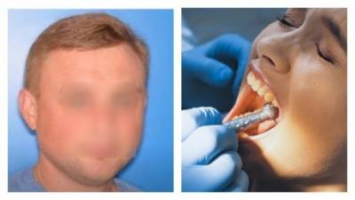 В СМИ раскрыли жуткие факты о киевском стоматологе, который хотел убить свою тещу