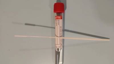Роспотребнадзор предложил отметить двойной ПЦР-тест при въезде в Россию для вакцинированных граждан