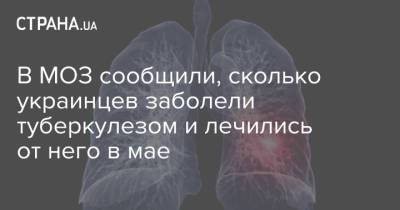 В МОЗ сообщили, сколько украинцев заболели туберкулезом и лечились от него в мае