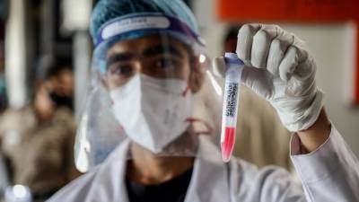 Эпидемиолог назвала симптомы индийского штамма коронавируса