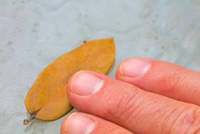 На какие проблемы со здоровьем указывают белые пятна на ногтях
