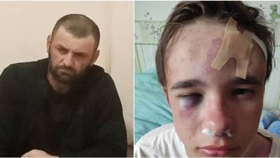 В Петербурге задержаны подозреваемые в избиении 16-летнего подростка