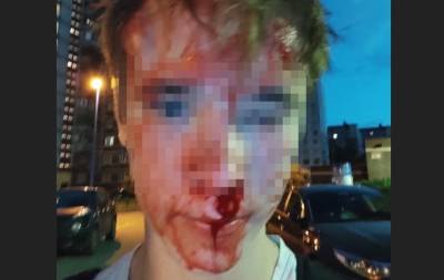 В Петербурге арестовали мужчин, избивших подростка из-за сережки в ухе