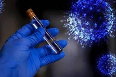 Еще 50 человек заболели коронавирусом в Чувашии, четверо умерли