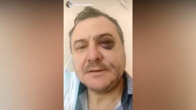 Экс-солиста "Лесоповала" избили после концерта в Сочи