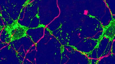 В мозге нашли два новых типа клеток с неизвестной функцией