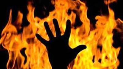 На Одесщине трое детей разлили бензин и чуть не сгорели заживо: спасал из огня отец