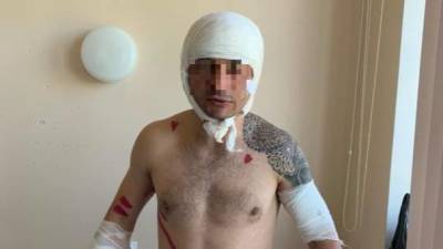 "Из кустов вынырнул и набросился": Сахалинец выжил в битве с медведем и сам добрался до больницы