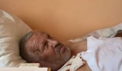 Тюменский лесничий пострадал в пожаре, его готовят к операции по пересадке кожи