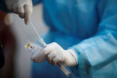 На Кубани за сутки выявили 116 новых зараженных коронавирусом
