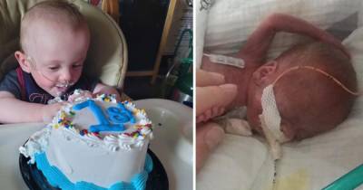 "Врачи давали 0%": самый недоношенный ребенок в мире отпраздновал первый день рождения (фото)