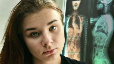 Нужна помощь: Женю Косыгину спасет операция на позвоночнике