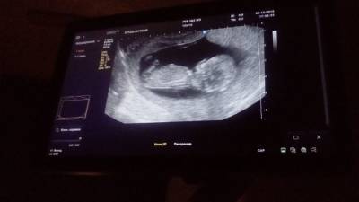 Женщина из ЮАР, заявившая о рождении сразу десяти детей, сфабриковала свою беременность