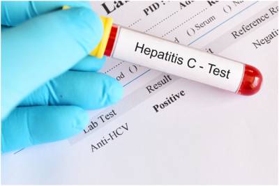 Что означает наличие антител к гепатиту С?