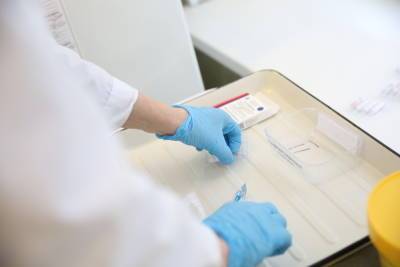 Петербургские лаборатории «Инвитро» перестали проводить тесты на антитела к COVID-19